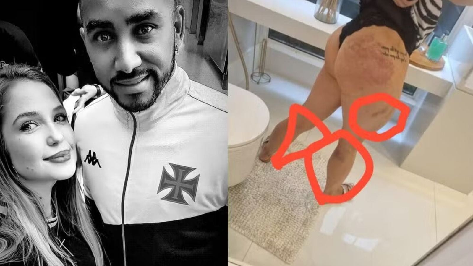 Justiça reabre processo contra Payet, ex-Vasco, por violência sexual