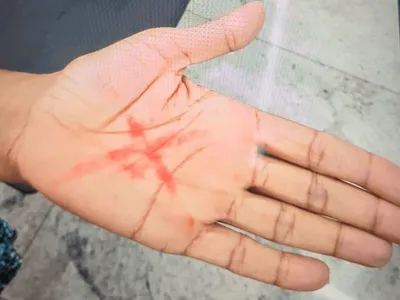 Mulher denuncia agressão após fazer um "X" na mão com batom em Americana