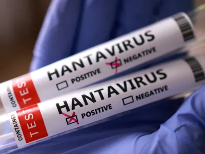 Alerta de Hantavírus: Infectologista detalha riscos de nova cepa