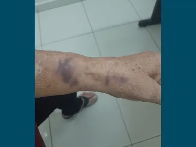 Homem é preso após agredir mãe de 75 anos com vassoura em Rio Claro