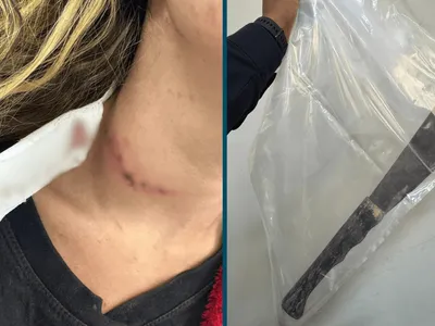 Homem é preso após cortar pescoço da companheira com facão em Piracicaba