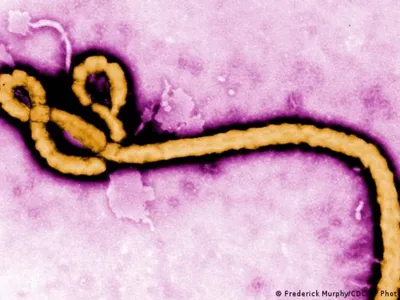 Secretaria descarta caso suspeito de ebola em São Paulo