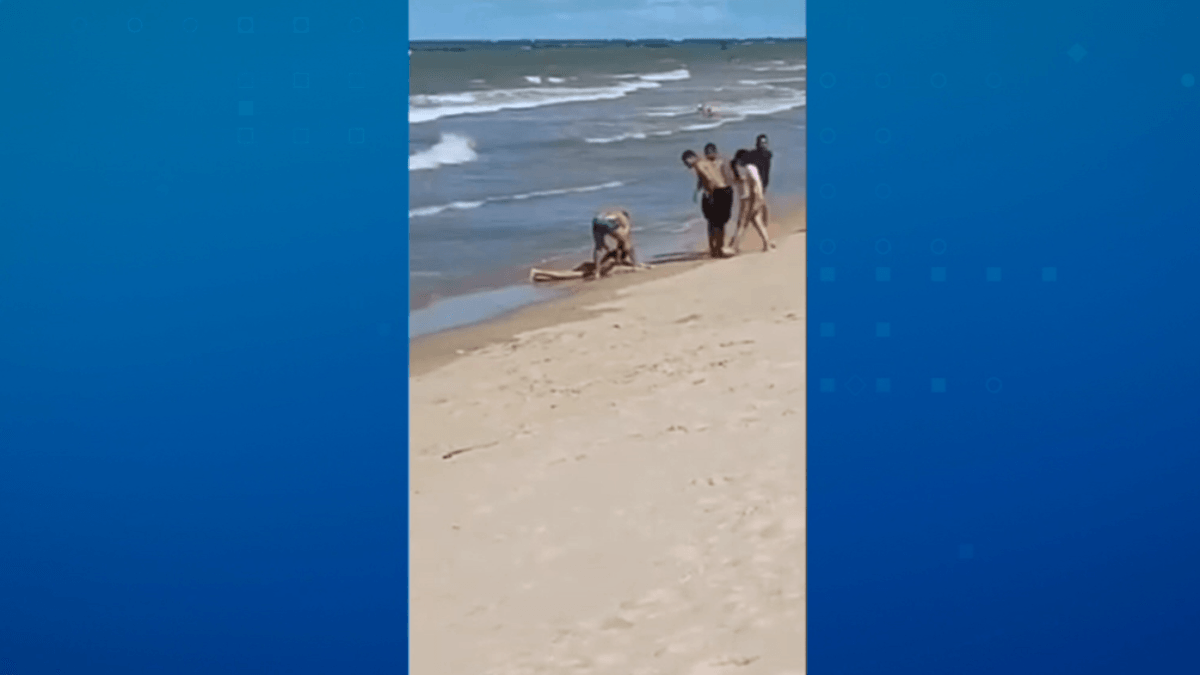 Menino atacado por tubarão na Praia de Piedade (PE) tem perna amputada