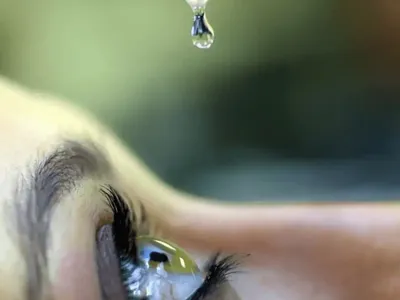 Uso indiscriminado de corticoides pode causar glaucoma e cegueira