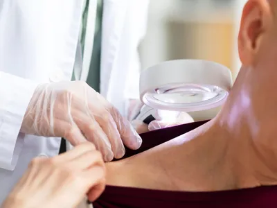 Dermatologia: como é a carreira do médico que trata pele, cabelos e unhas