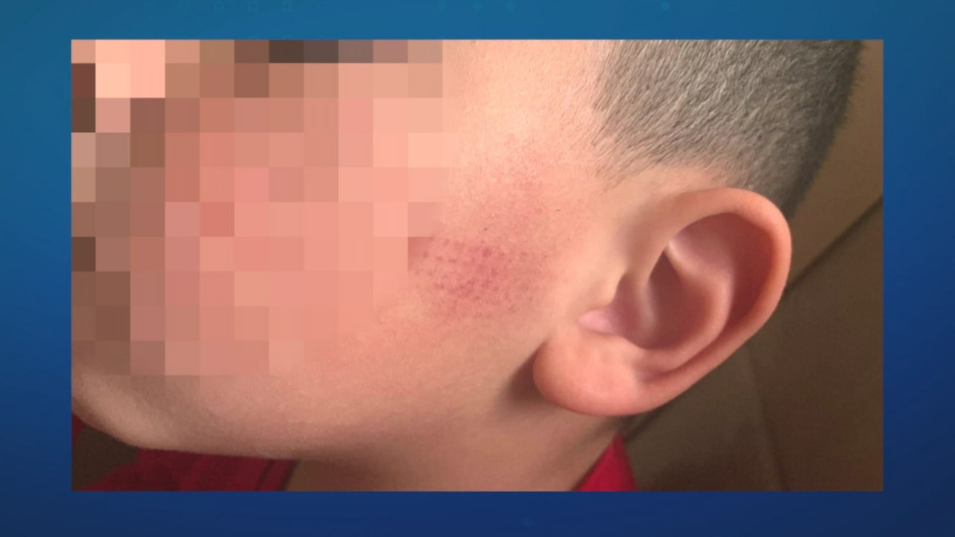 Pais denunciam agressões de professora em escola Militar no RS