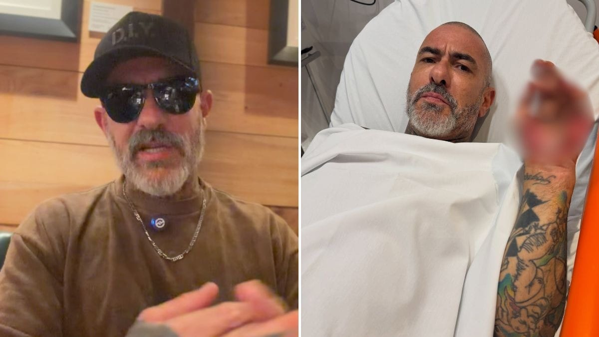 Fogaça fala sobre acidente de moto e mostra ferimento: "Não morri por Deus"