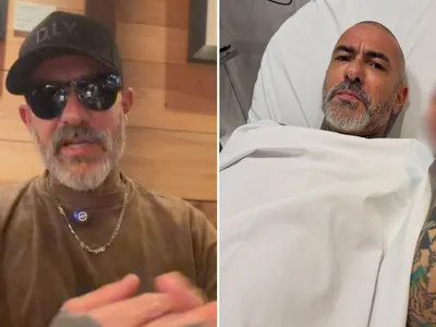 Fogaça fala sobre acidente de moto e mostra ferimento: "Não morri por Deus"