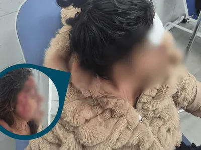 Mulher escapa de cárcere privado e denúncia agressões do companheiro
