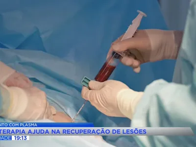 CFM libera uso de plasma rico em plaquetas em quatro tipos de lesão
