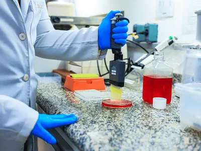 Unicamp desenvolve técnica que pode ampliar acesso ao transplante capilar