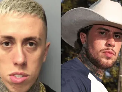 "Milagres acontecem": veja todos os "rostos" do Mc Daniel após procedimento