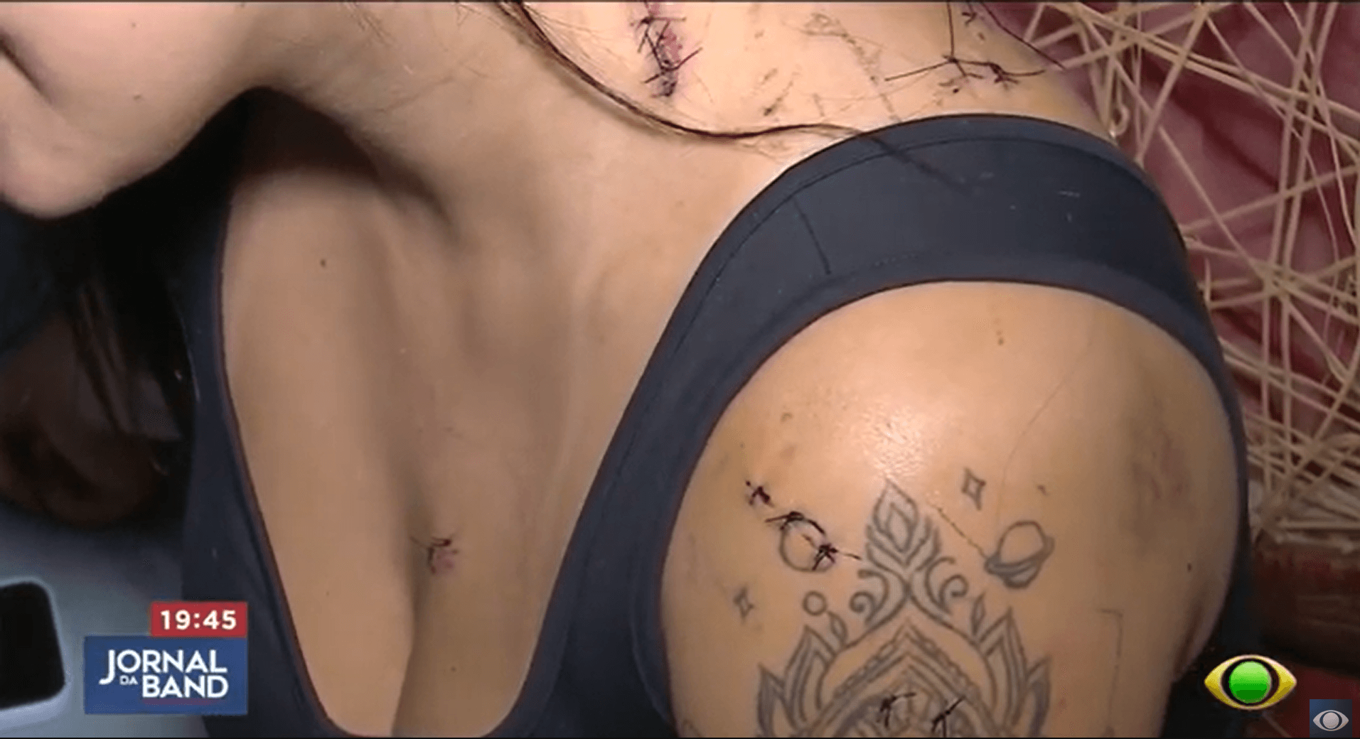 Jovem sobrevive a tentativa de feminicídio após levar 10 facadas