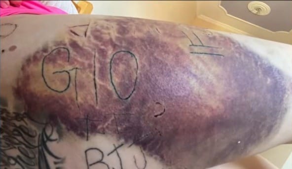 Mulher é torturada por 11h pelo ex com jogo macabro, navalhas e tatuagem