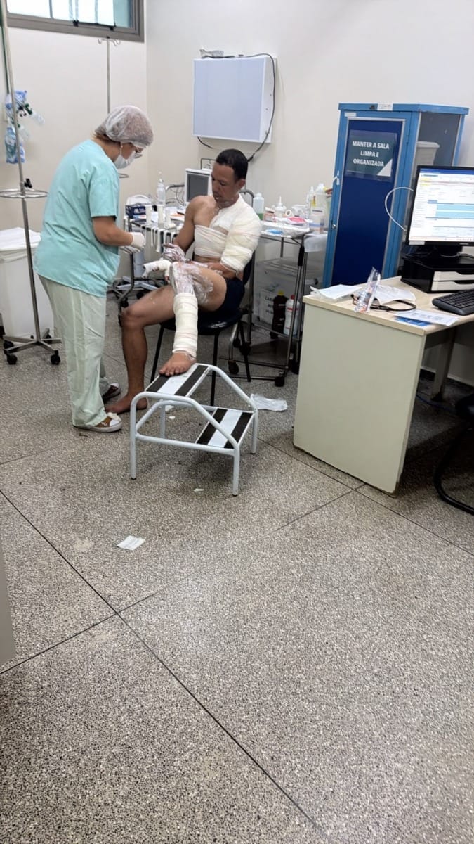 Homem é preso por atear fogo na ex-namorada; vítima está em estado grave