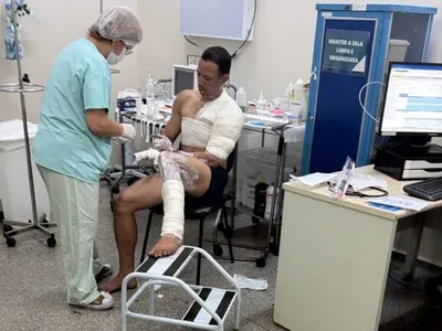Homem é preso por atear fogo na ex-namorada; vítima está em estado grave