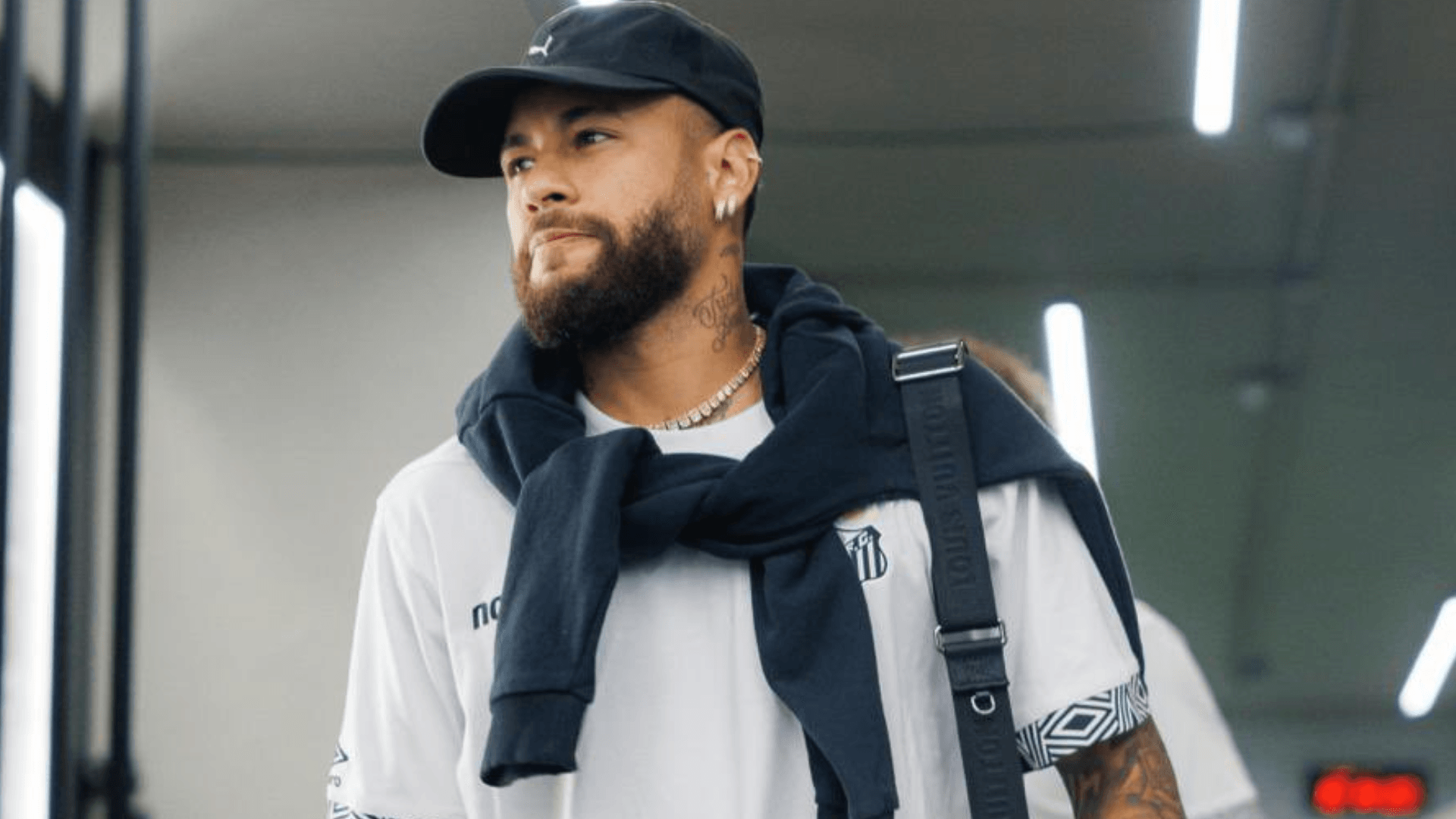 Santos x Remo: veja escalações para jogo da Copa do Brasil