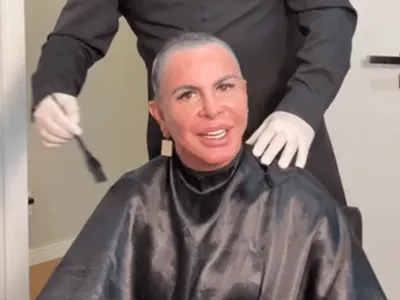 Aos 67 anos, Gretchen raspa a cabeça ao vivo para transplante capilar; veja