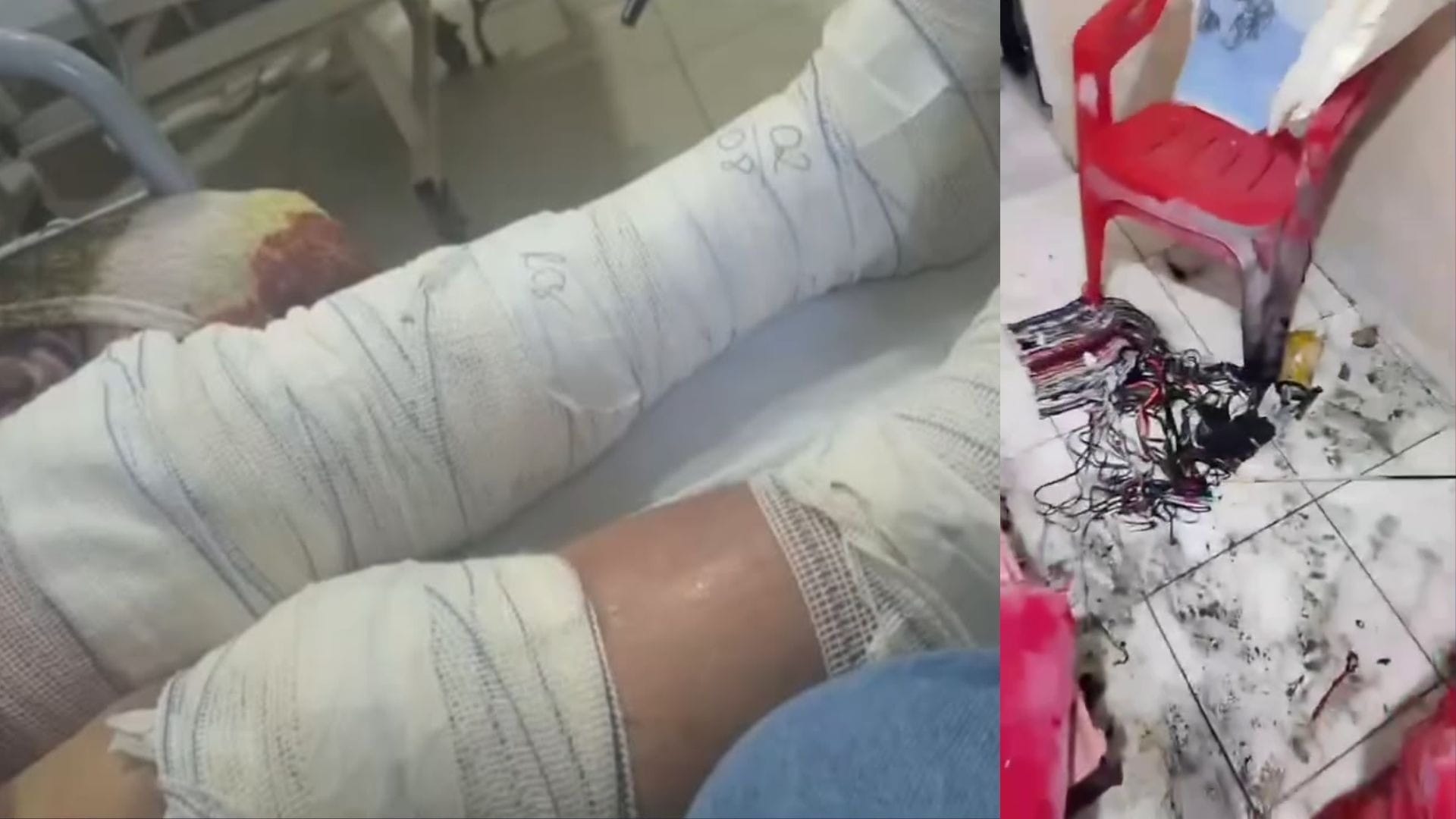 Idosa fica ferida após balão cair em casa de Nova Iguaçu - QTU Questões do Universo
