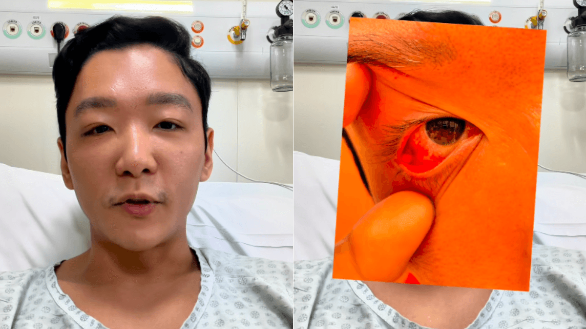 Campeão do MasterChef, Cesar Yukio é internado após infecção grave no olho