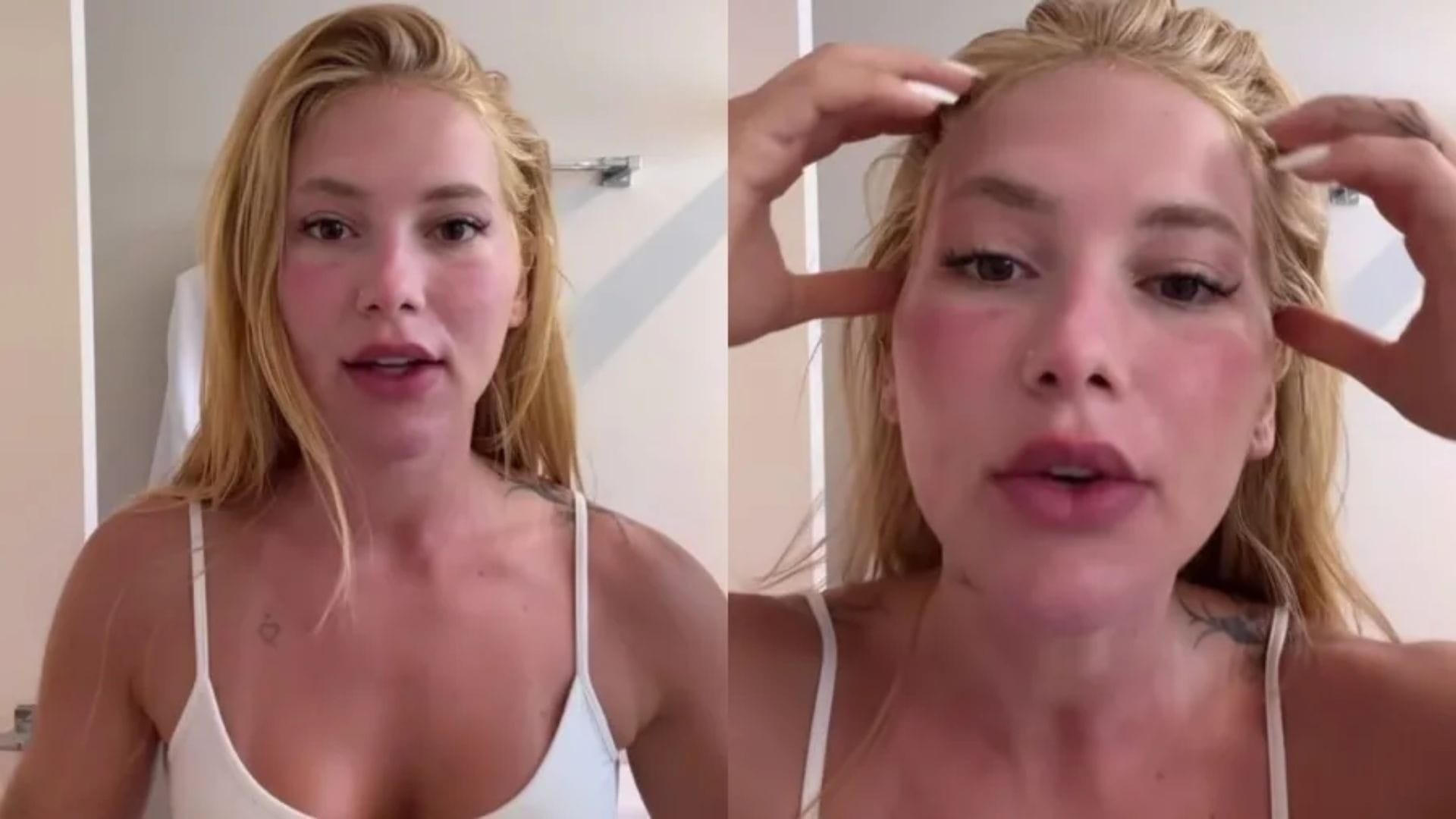 Virginia Fonseca aparece com rosto inchado após Xerf e Ultrapulse; conheça