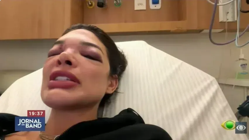 Empresário vira réu por agredir esposa com taco de beisebol e segue preso