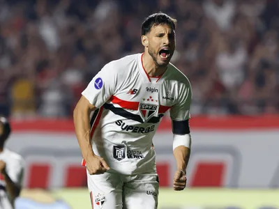 São Paulo atualiza situação de Calleri após lesão no tornozelo
