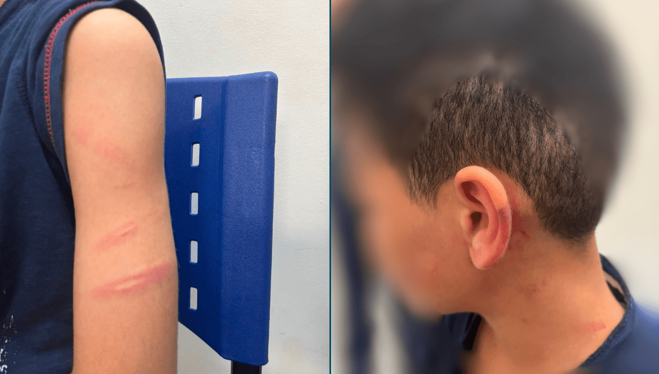 Padrasto é preso após agredir menino de 12 anos em Artur Nogueira