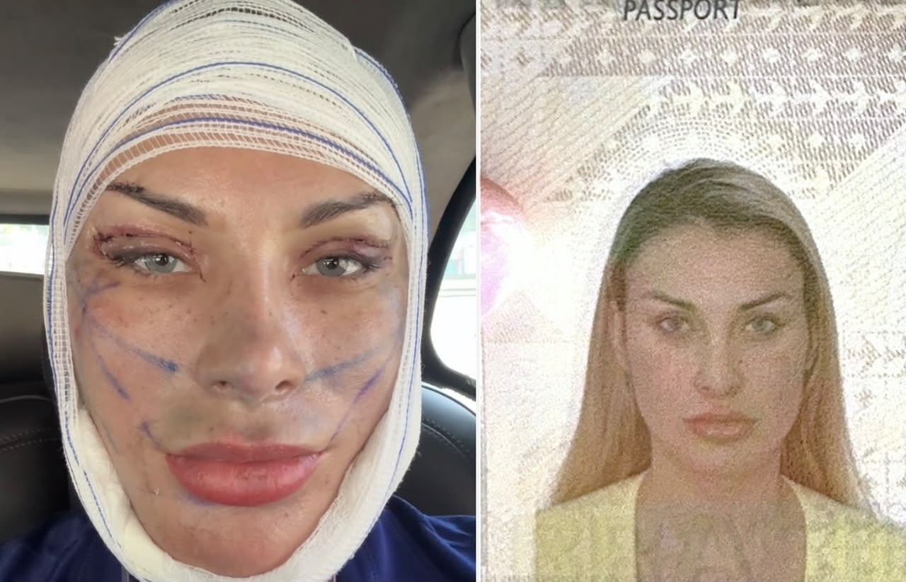 Andressa Urach passa por perrengue com biometria facial após cirurgias