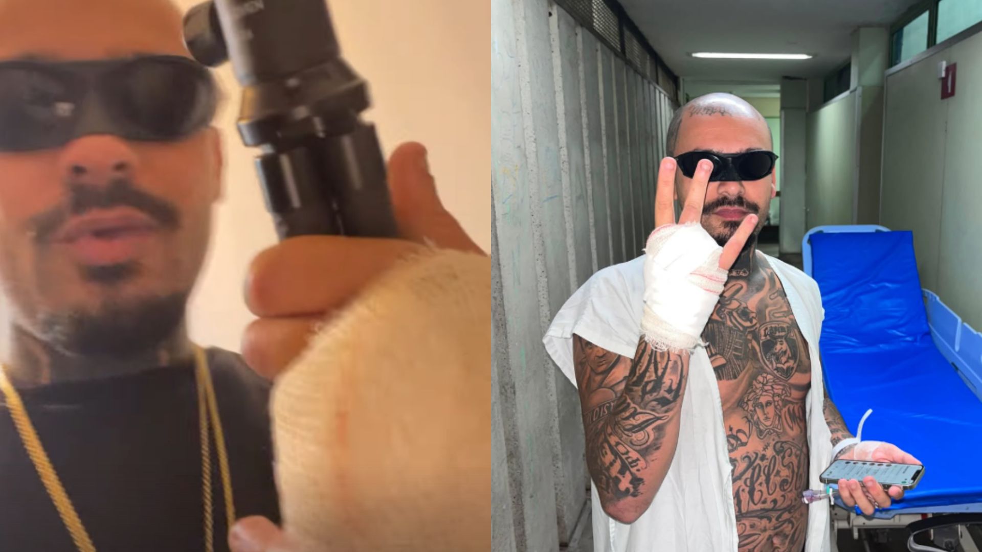 Streamer decide leiloar dedo que perdeu ao tentar invadir Rock in Rio