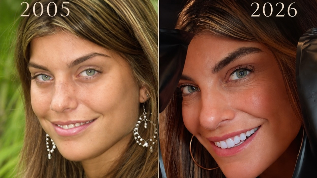 Joana Balaguer, de Malhação, impressiona com antes e depois; veja foto