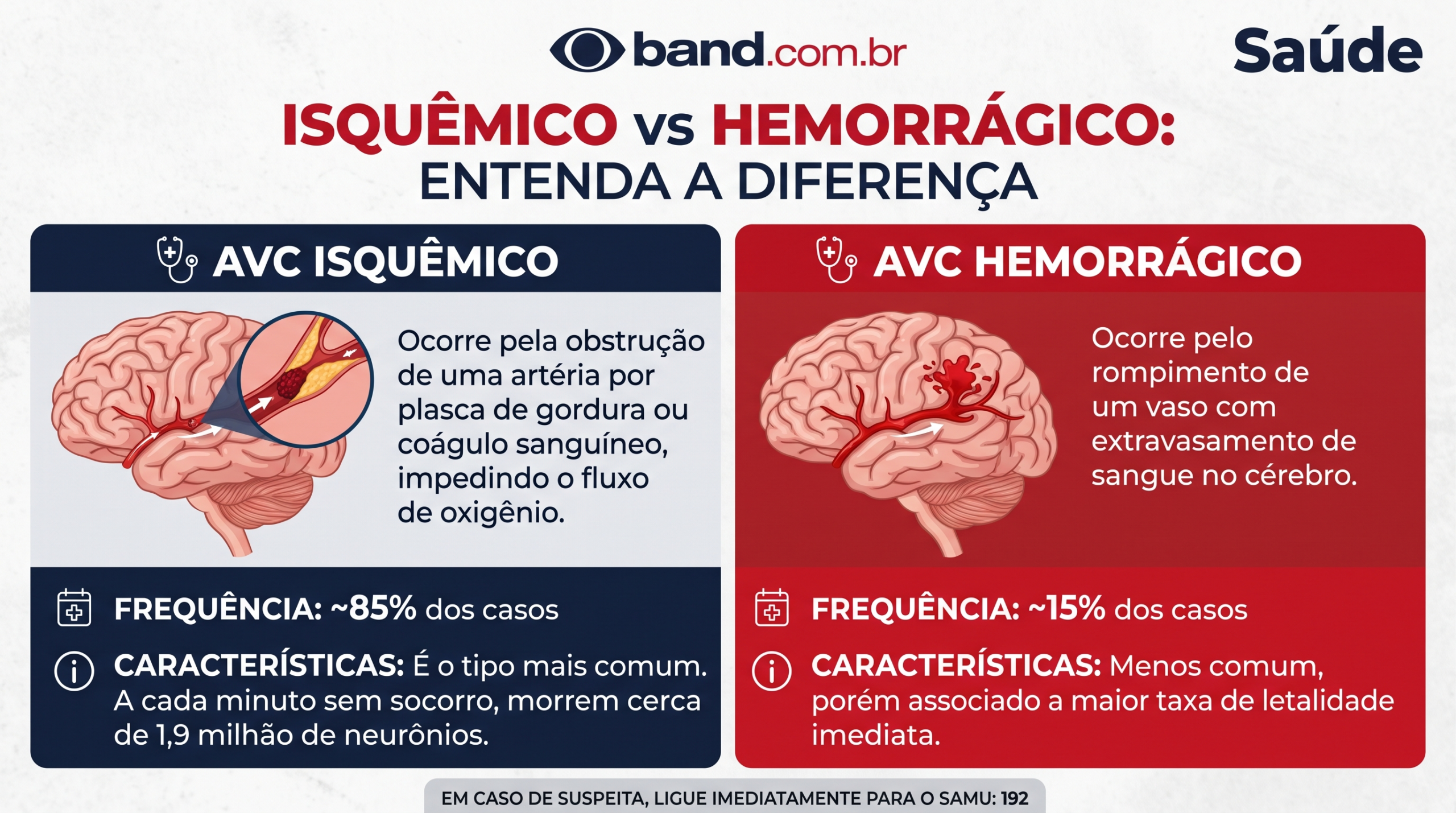 AVC mata uma pessoa a cada 6 minutos no Brasil