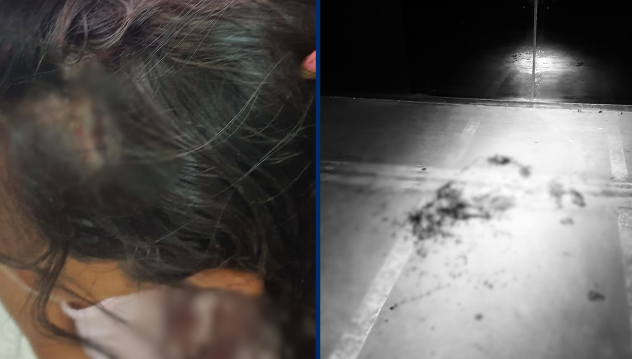 Homem é preso após agredir esposa com soco e corte na cabeça em Americana