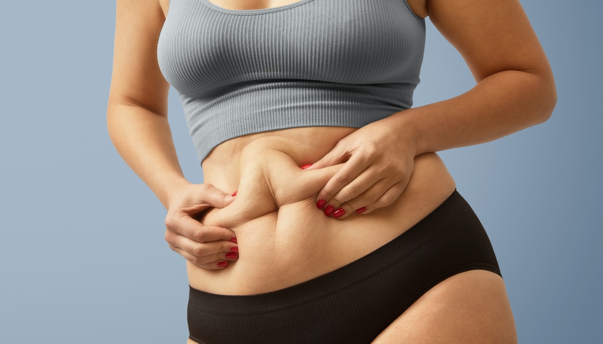 Excesso de pele após bariátrica: quando cirurgia vai além da estética